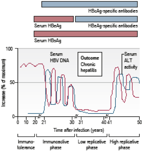 Graph showing phases of a chronic HBV infection following infection at birth